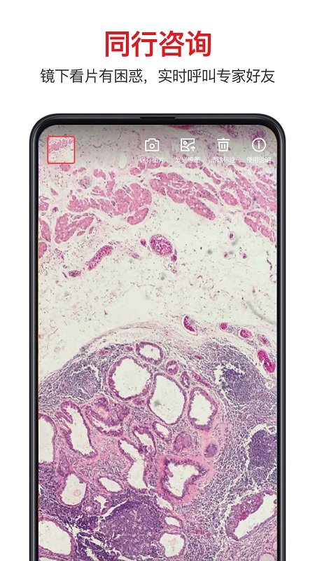 爱病理app 爱病理官方版下载
